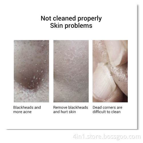 Electronic blackhead remover vacuum